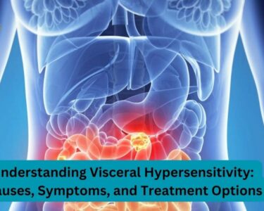 Understanding Visceral Hypersensitivity: Causes, Symptoms, and Treatment Options