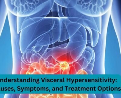 Understanding Visceral Hypersensitivity: Causes, Symptoms, and Treatment Options