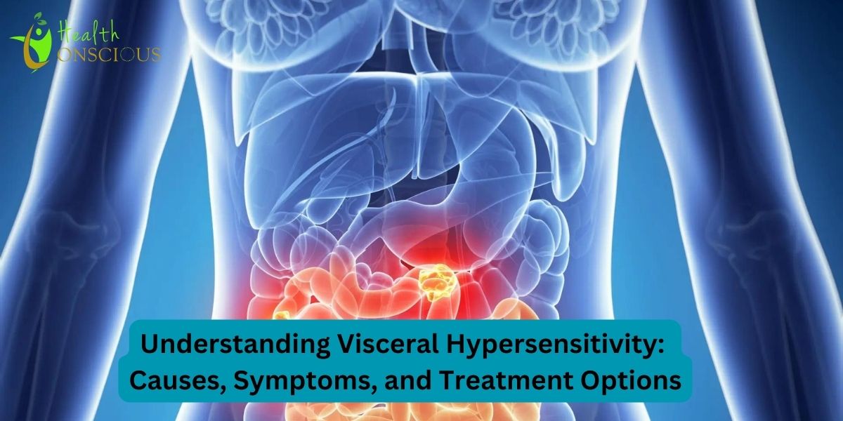 Understanding Visceral Hypersensitivity: Causes, Symptoms, and Treatment Options