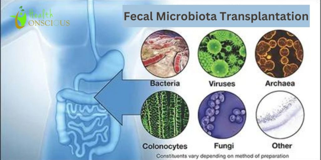 Fecal Microbiota Transplantation