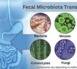 Fecal Microbiota Transplantation