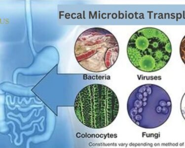 Fecal Microbiota Transplantation