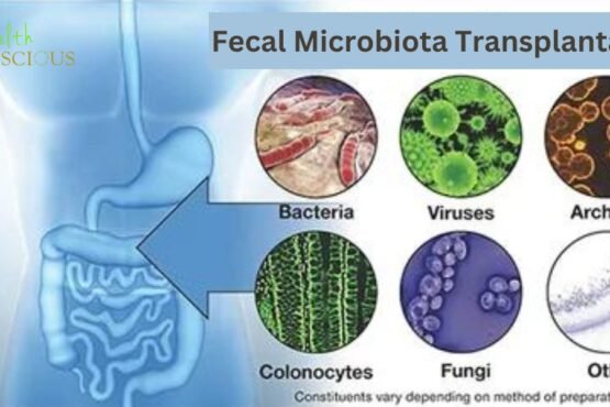 Fecal Microbiota Transplantation