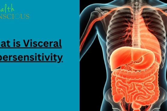 what is visceral hypersensitivity