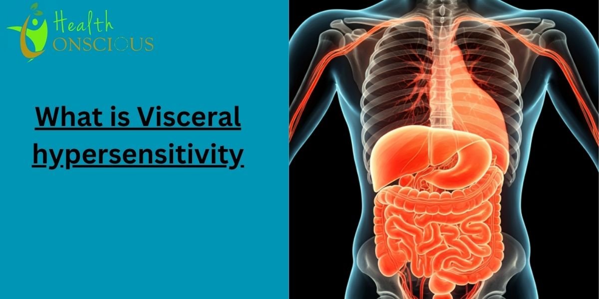 What is Visceral Hypersensitivity and How Is It Treated?