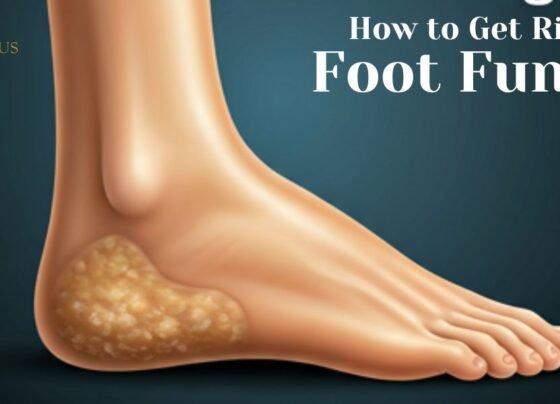 How to Get Rid of Foot Fungus