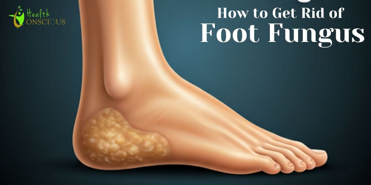 How to Get Rid of Foot Fungus: Understanding Causes, Symptoms, and Effective Solutions