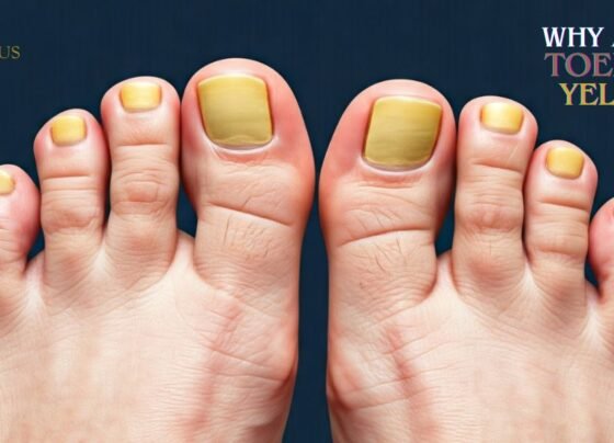 Why Are My Toenails Yellow