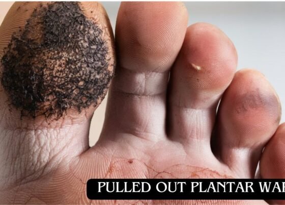 Effective Treatments for Pulled Out Plantar Wart Root: Removal & Prevention Tips