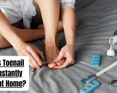 What kills Toenail Fungus Instantly Naturally at Home? Causes,Treatments & Remedies