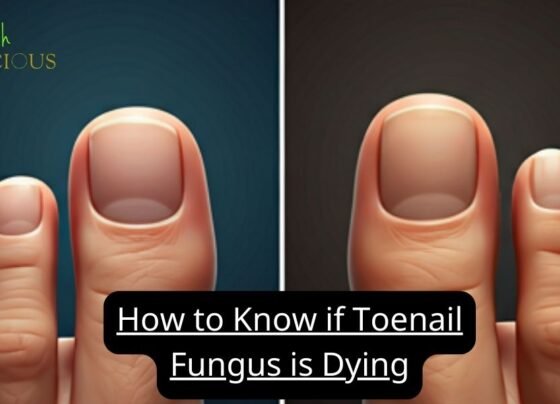 How to Know if Toenail Fungus is Dying