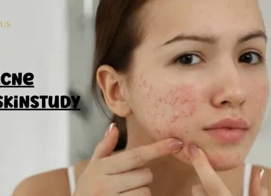 Acne ClearSkinStudy