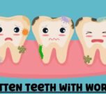 Rotten Teeth with Worms