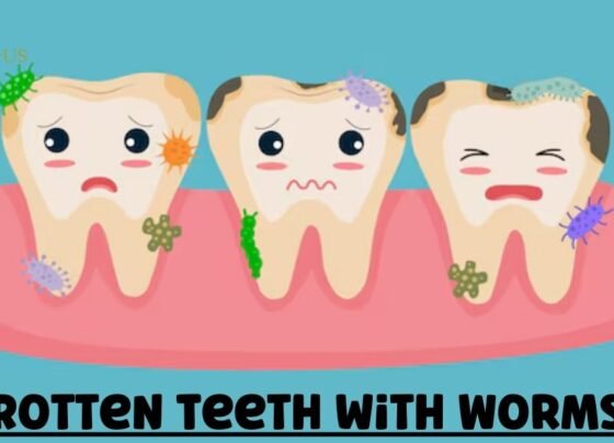 Rotten Teeth with Worms