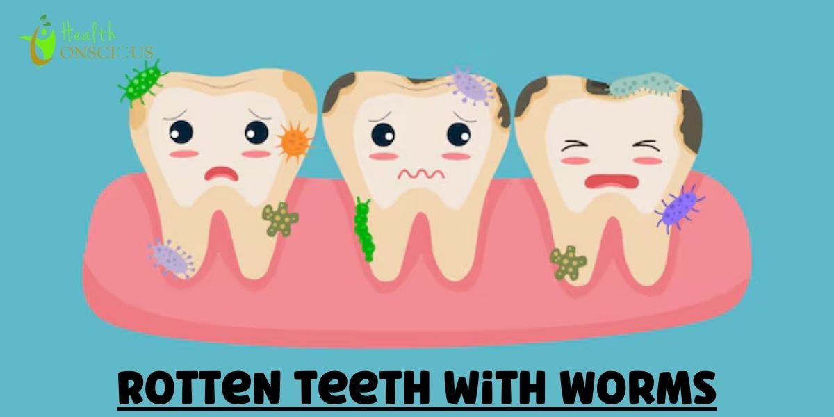 Rotten Teeth with Worms: The Truth Behind the Myth & Real Causes of Decay