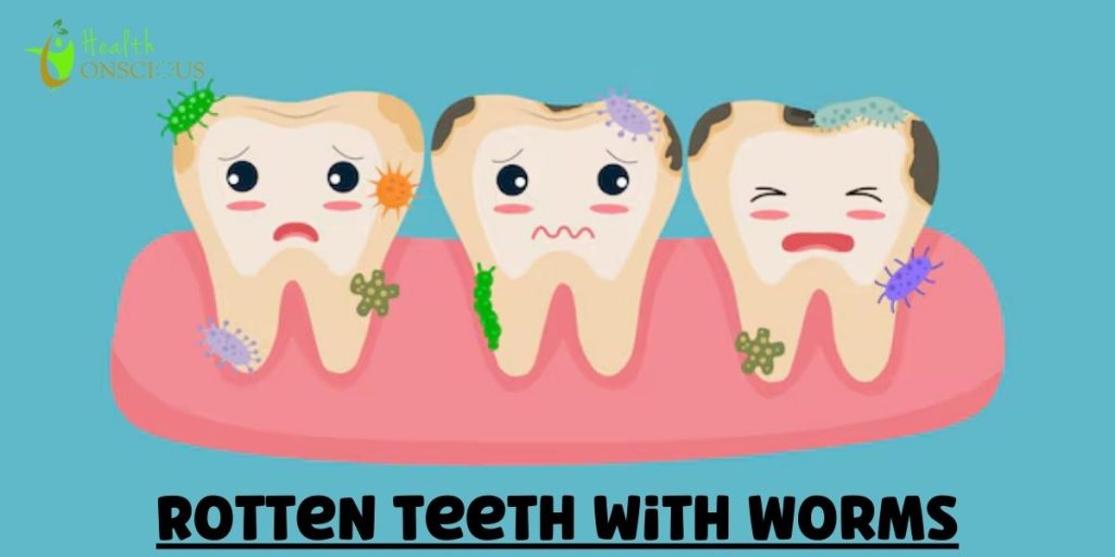 Rotten Teeth with Worms