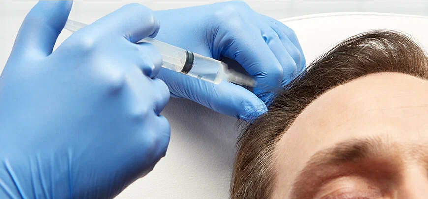 Does PRP Hair Therapy Really Work? Expert Insights