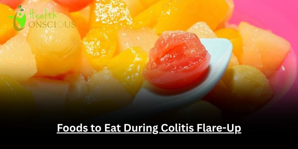 Foods to Eat During Colitis Flare-Up