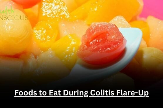 Foods to Eat During Colitis Flare-Up