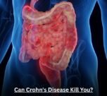 Can Crohn's Disease Kill You