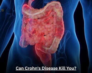 Can Crohn's Disease Kill You