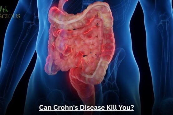 Can Crohn's Disease Kill You