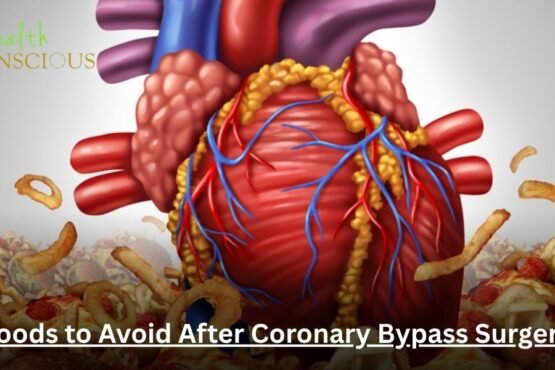 Foods to Avoid After Coronary Bypass Surgery