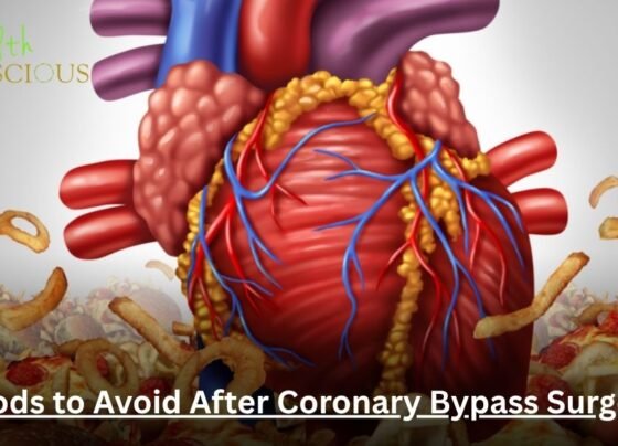 Foods to Avoid After Coronary Bypass Surgery