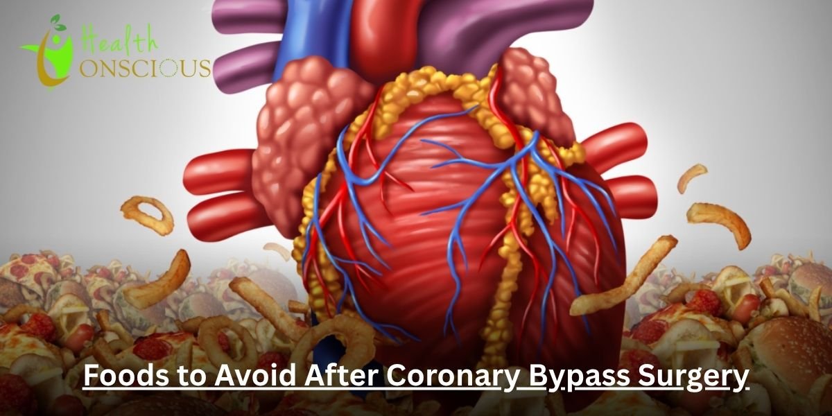 Top 9 Foods to Avoid After Coronary Bypass Surgery for a Healthy Recovery