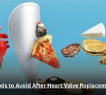 Foods to Avoid After Heart Valve Replacement