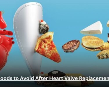 Foods to Avoid After Heart Valve Replacement