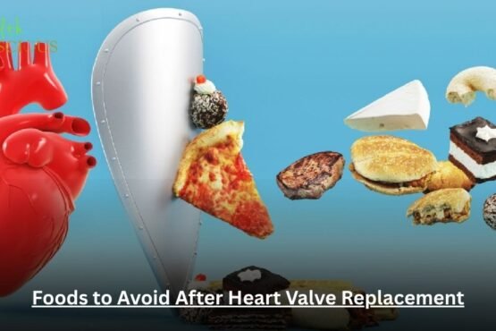 Foods to Avoid After Heart Valve Replacement