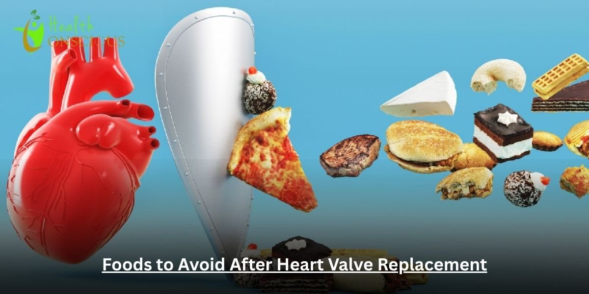 Foods to Avoid After Heart Valve Replacement