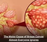 The Major Cause of Breast Cancer Almost Everyone Ignores