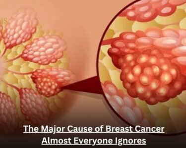 The Major Cause of Breast Cancer Almost Everyone Ignores