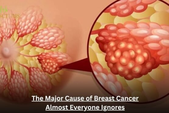The Major Cause of Breast Cancer Almost Everyone Ignores