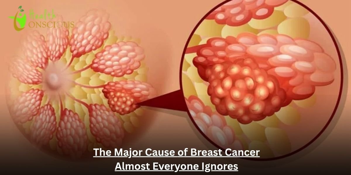 The Major Cause of Breast Cancer Almost Everyone Ignores