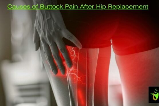 Causes of Buttock Pain After Hip Replacement