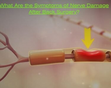 What Are the Symptoms of Nerve Damage After Back Surgery