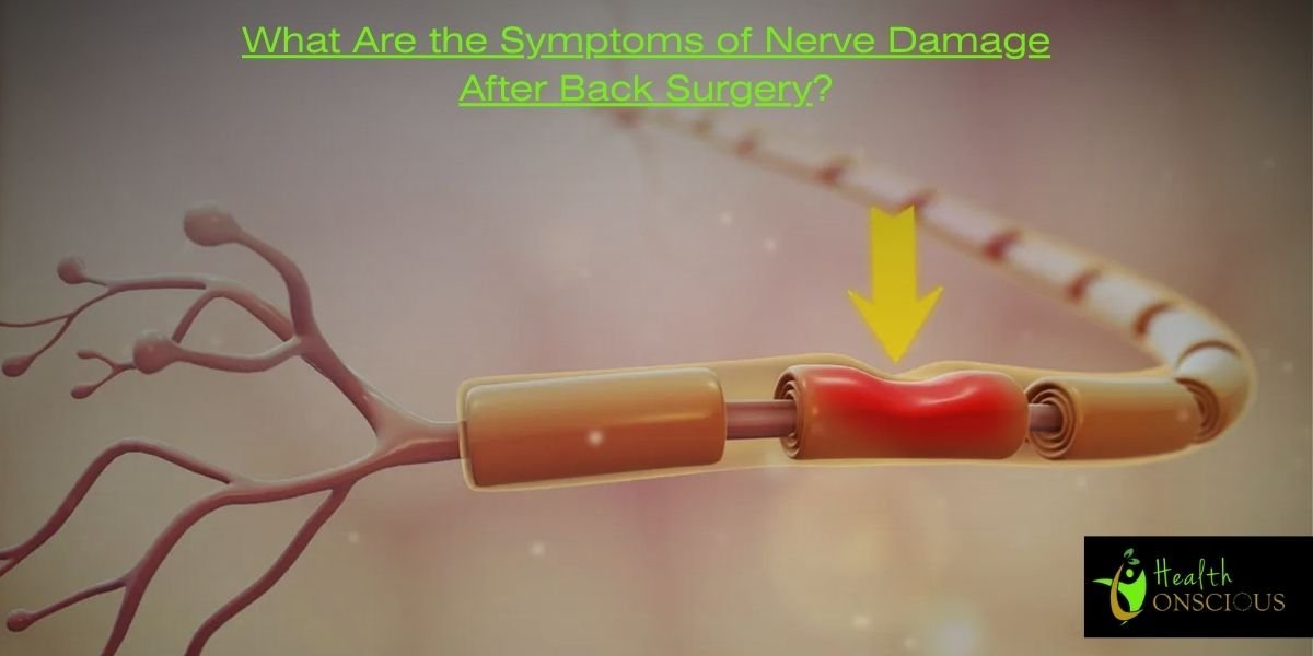 What Are the Symptoms of Nerve Damage After Back Surgery?