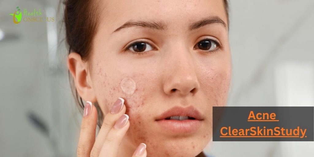 Acne ClearSkinStudy