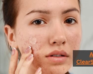 Acne ClearSkinStudy