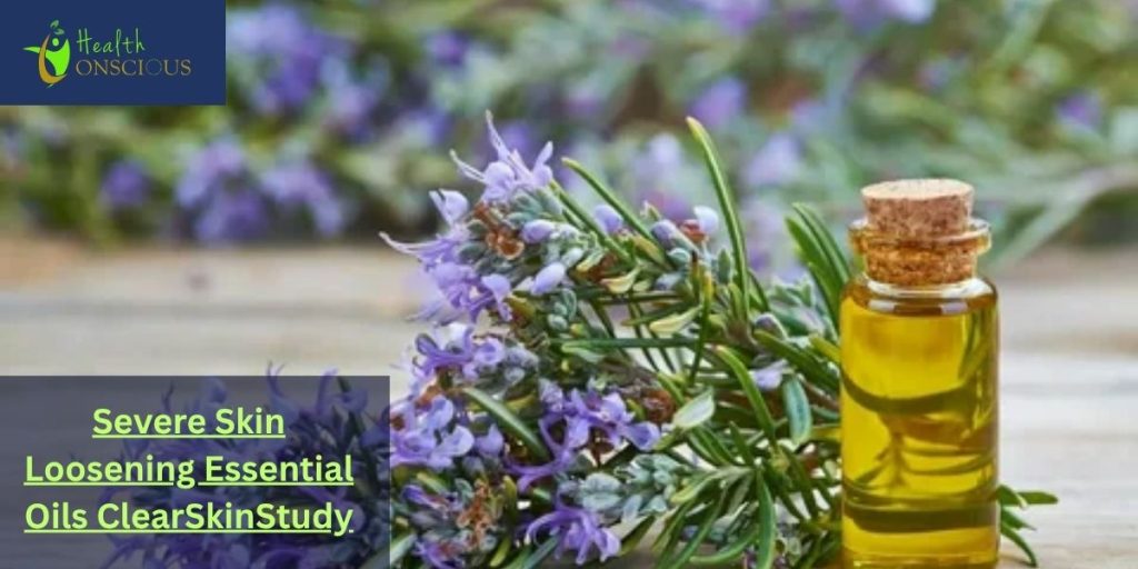 Severe Skin Loosening Essential Oils ClearSkinStudy