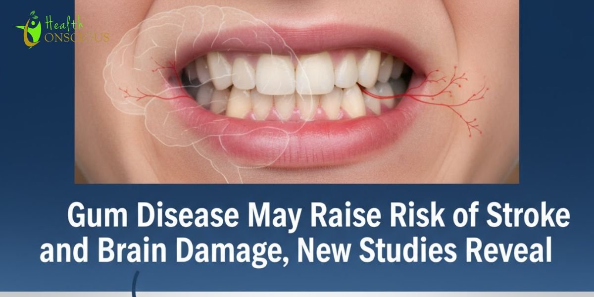 Gum Disease May Raise Risk of Stroke and Brain Damage, New Studies Reveal