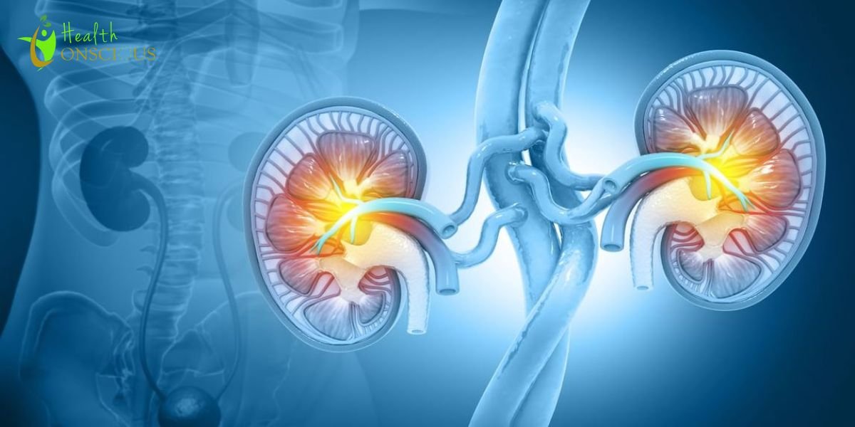 Chronic Kidney Disease Ranks Among Top 10 Global Causes of Death, New Analysis Reveals