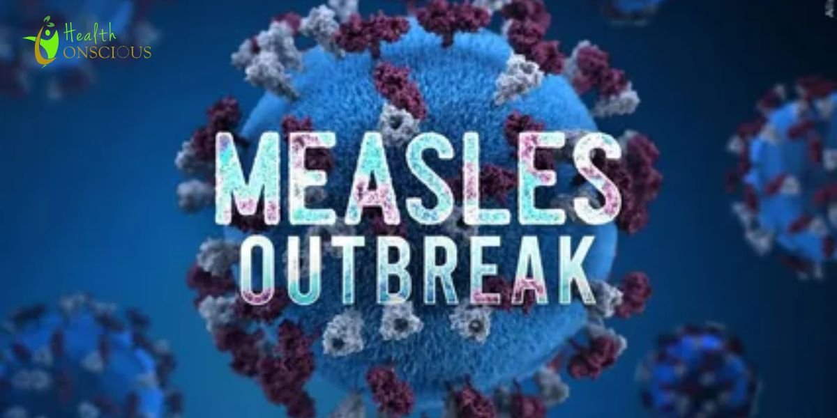 Canada No Longer Measles-Free: Are U.S. Outbreaks on the Horizon?