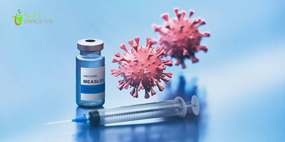 South Carolina Measles Outbreak Hits Record 876 Cases: Is the Spread Finally Slowing?