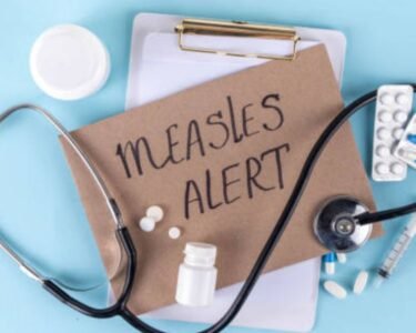Five Measles Cases Confirmed in Lancaster: Cocalico Schools and Arts Academy Under Warning